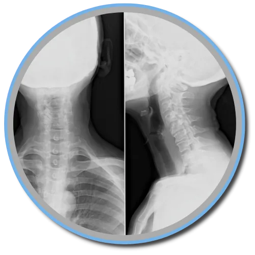 Gonstead X-rays in Durham